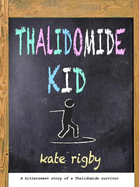 thalidomide-kid-sept-18.jpeg