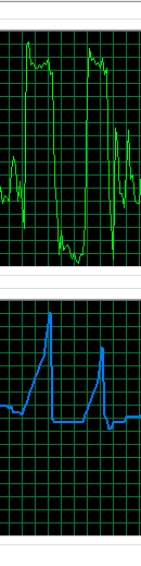 Opera high CPU and RAM usage