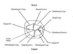 Molar Mass Drawing, Mandibular 1st Molar Anatomy, Mandible Labeling, Mandible Labeled, Mandibular 2nd Molar Drawing, Molars Teeth, Molar Anatomy, First Molar Anatomy, Maxillary First Molar