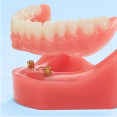 Dentures with Same Day Denture Replacements and Repairs Complete Denture, Snap On Dentures, How To Use Fixodent Denture Adhesive Cream, Full Dentures, Removable Partial Denture, How To Choose Denture Adhesive, How To Use Fasteeth Denture Adhesive, Permanent Dentures, Denture Sure Fit