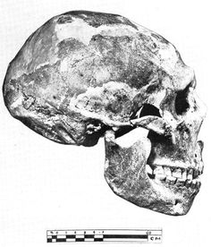 an image of a human skull in black and white, with the bones labeled below