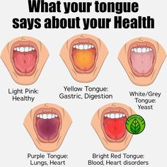 Tongue Color Meaning, What Does A White Tongue Mean, What Does The Color Of Your Tongue Mean, Tongue Health Chart, How To Get A Healthy Tongue, Ayurveda Tongue Chart, How To Brush Your Tongue, Ayurvedic Tongue Chart, How To Have A Healthy Tongue