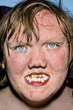a young man with freckled hair and blue eyes is posing for the camera