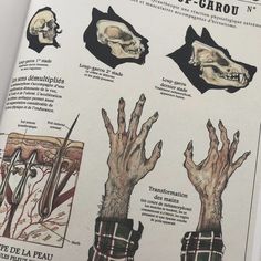 an open book with pictures of hands and bones