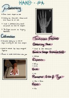the hand and fingers are labeled in different languages, including an x - ray image