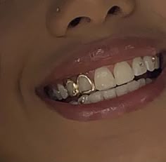 Gold Teeth Emoji, Gold Teeth Grills Aesthetic, Grills For Girls Teeth, Two Gold Teeth Women, Grill Inspo Girl, Girls Grills Teeth, Grill For Women, Female Grillz Gold, Mrs Grillz