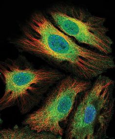 an image of some green and yellow cells