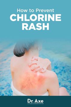 Because chlorine can zap moisture from skin and disrupt normal sebum (oil) production, a risk you take when swimming in some pools is the potential to develop an itchy, red chlorine rash. Learn how to prevent it. How To Lower Cyanuric Acid In Pool Naturally, How To Lower Chlorine In Pool Naturally, How To Use Natural Chemistry Pool First Aid, How To Treat Heat Rash Naturally, How To Heal A Rash, Chlorine Rash, How To Lower Cya In Pool Naturally, How To Treat Heat Rash, Treating Heat Rash