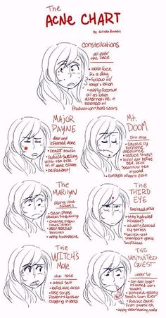 The Acne Chart (by Colleen Butters) shows you how to treat your pimple at differ... Check mor... #howtotightenlooseskinonneck Pimple Chart Meaning, Pimple Chart, Face Pimple Chart, Pimple Location Chart, Acne Guide, How To Get Rid Of Blind Pimples, Blind Pimple Remedies, What Your Pimples Mean, Blind Pimple Remedy