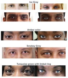 Bright Ocular, Change Your Eye color permanently Different Grey Eye Colors, Eye Color Genes, Eye Color Genetics, Changing Eye Color Naturally, Eye Color Comparison, Eye Color Change Naturally, Eye Color Chart Genetics, How Can You Change Your Eye Color, How To Change The Color Of Your Eyes