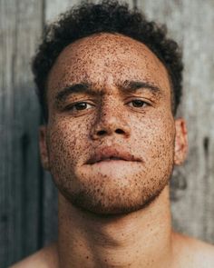 a man with freckles on his face and chest