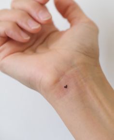 a person's arm with a small black dot on it