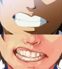 two pictures of the same person's teeth