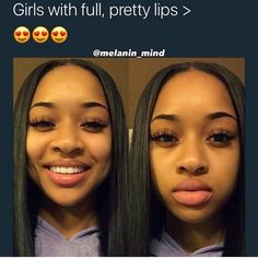 15.8k Likes, 261 Comments - Ace/39.1K+ Spades (@scalpedbih) on Instagram: “I know her lip gloss be poppin” Cute Lip Shapes, Different Dimples, Big Top Lip And Small Bottom Lip, 4 Dimples, Black Dimple, Lip Dimples, India Royale Old Pictures, India Royale Lashes, Braceface Baddie