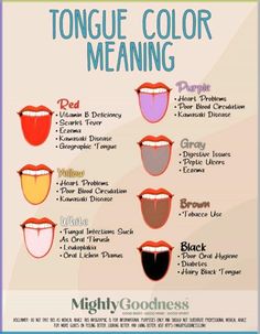 Tongue Color 7 Scary Tongue Color Meanings Mighty Goodness Healthy Tongue, Five Senses Worksheet, How To Help Nausea, Chart Infographic, Tongue Health, Health Signs, Preventative Health, Color Meanings, Fungal Infection