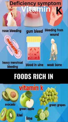 Did you know Vitamin K plays a vital role in blood clotting, bone health, and heart health? Deficiency can lead to symptoms like excessive bleeding, easy bruising, and weak bones. 🩸🦴 If you're noticing these signs, it might be time to check your Vitamin K levels! Learn more about how to boost your intake naturally through leafy greens and supplements. 🌿💊 #VitaminK #HealthTips #Nutrition #WellnessJourney" Vitamin K Deficiency Symptoms, Vitamin K Benefits, Foods With Vitamin K, Healthy Diet Vitamin K Sources, What Is Vitamin K, Health Benefits Of Vitamin K, Benefits Of K2 Vitamin, What Does Vitamin K2 Do, K2 Vitamin Health Tips