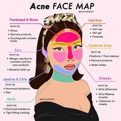 Face Mapping Acne, Face Mapping, Bad Acne, Skin Care Routine Order, Basic Skin Care Routine, Clear Skin Tips, Healthy Skin Tips, Perfect Skin Care Routine, Facial Skin Care Routine