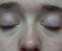 a close up of a person with their eyes closed and one eye partially closed to the camera