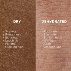 Do you have dry or dehydrated skin? Comment below 👇🏼 #dryvsdehydrated #marycohr #dryskin #dehydratedskin Foundation For Dry Skin, Skin Facts, Esthetician Marketing, Skin Aesthetics, Combination Skin Type, Simple Skincare Routine, Skin Secrets, Winter Skin, Skin Clinic