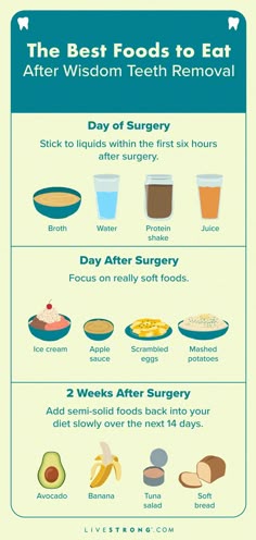 Foods After Wisdom Teeth, Foods After Wisdom Teeth Removal, Wisdom Teeth Foods, Foods For After Wisdom Teeth Removal, What To Eat After Wisdom Teeth, Food After Wisdom Teeth Removal, Foods To Eat After Wisdom Teeth Removal, Foods For Wisdom Teeth Recovery, Meals To Eat After Wisdom Teeth Removal